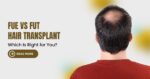 FUE vs FUT Hair Transplants: Which is Right For You?
