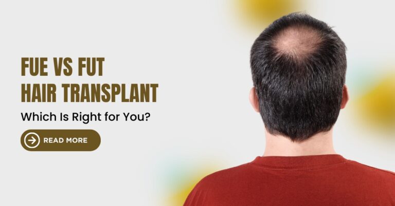 FUE vs FUT Hair Transplants