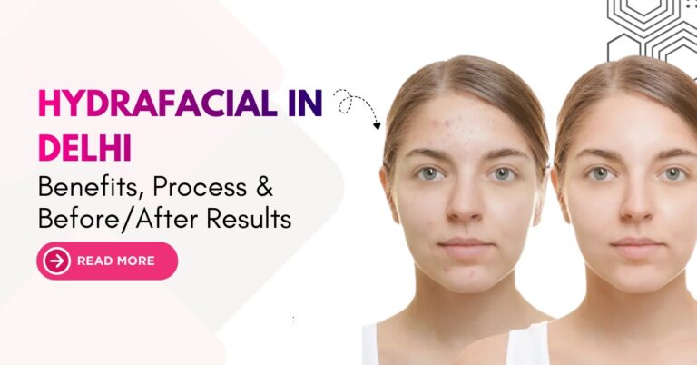 Hydrafacial in Delhi